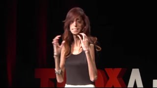 How do you define yourself  Lizzie Velasquez  TEDxAustinWomen [upl. by Armillia]