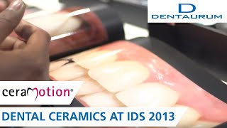 The ceraMotion® moment  dental ceramics at IDS 2013 [upl. by Gruber]