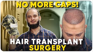 Hair Transplant in Jaipur  Best Results amp Cost of Hair Transplant in Jaipur [upl. by Auberbach]