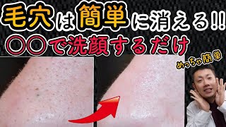 【肌がきれいになる】ベビーオイル洗顔は毛穴の汚れをゴッソリ取って美肌や陶器肌にしてくれる！【美肌スキンケア】 [upl. by Essam211]