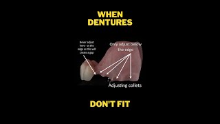 What to do when Dentures dont fit [upl. by Rabbi]