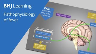 Pathophysiology of fever explained [upl. by Ecinereb626]