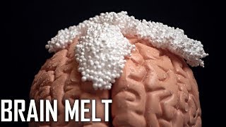 ASMR BRAIN MELT [upl. by Watkin]