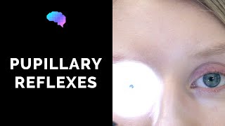 Pupillary Reflexes  OSCE Guide Clip  UKMLA  CPSA [upl. by Teresa]