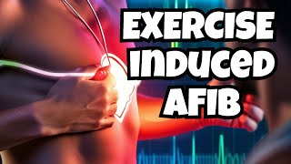 Exercise Induced AFib Expert Tips [upl. by Aneer769]