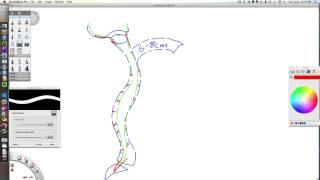 Meningeal AdhesionsRelease Explanation [upl. by Eelik296]