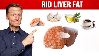 The BEST Foods for a Fatty Liver MUST WATCH [upl. by Grimona361]