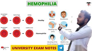 Hemophilia  Blood Clotting Disorder  Blood physiology [upl. by Alden]