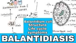 Balantidiasis  Balantidium coli Structure Life cycle Symptoms Medication  Bio science [upl. by Kally]