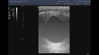 Ultrasound of 22 day old equine embryo [upl. by Chandal]