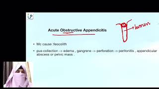 Appendicitis Surgery Demo Lecture Unani StepUp Dr Ifrah [upl. by Niehaus]