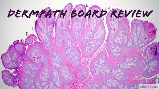 Dermatopathology Board Review for Dermatology Pathology Dermpath 19 Classic Cases [upl. by Eleonore]