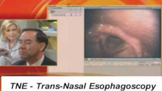 TNE TransNasal Esophagoscope Endoscopy Endoscope GMA [upl. by Giraldo116]