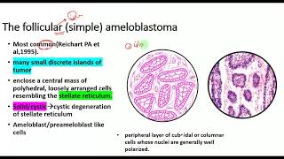 Ameloblastoma HISTOPATHOLOGYtypesRadiographic featuresclinical featuresOdontogenic tumors [upl. by Godewyn]