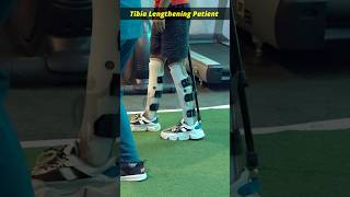 Limb lengthening surgery  Tibia lengthening surgery  heightincrease heightsurgery [upl. by Tunnell]