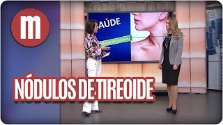 Nódulos de tireoide  Mulheres 25102016 [upl. by Lise485]