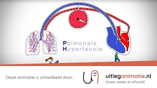 Uitleganimatie  VUmc Pulmonale Hypertensie [upl. by Oironoh]