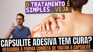 Capsulite adesiva O que causa e como tratar da forma correta Como recuperar o movimento do ombro [upl. by Rayna]