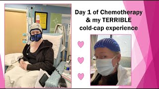 Day 1 of AC chemotherapy amp my TERRIBLE cold cap experience [upl. by Aitret691]