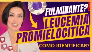 Como Identificar Leucemia Promielocitica no hemograma completo  tem cura [upl. by Glavin]