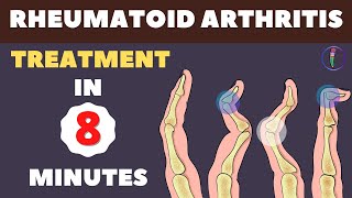 Rheumatoid Arthritis Treatment  New Medicines and Updates [upl. by Sayette]