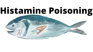 Histamine Poisoning [upl. by Enelegna]