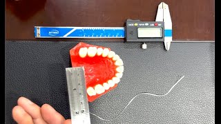 Inter molar distance or dental arch width measuring at home for patients [upl. by Rockwell]