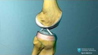 Knee Ligament Anatomy Animation [upl. by Stochmal431]