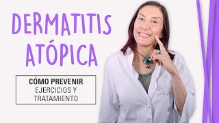 Dermatitis Atópica  Cómo Curar la Piel Atópica [upl. by Airres]