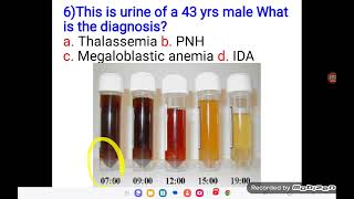 Haematology OSPE Part 2 [upl. by Gokey]