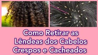 Como Eliminar as Lêndeas dos Fios de Cabelo e Como Acabar com os Piolhos  Como Retirar as Lêndeas [upl. by Aloysia]