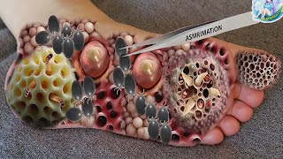 ASMR Infected Foot Treatment Animation Dog Tick amp Maggot Removal  Deep Cleaning Animation [upl. by Alyek]