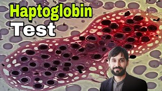 Haptoglobin Test  Haptoglobin Blood Test  MLT Hub with kamran [upl. by Donnenfeld]