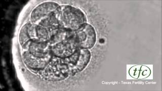 Human Embryo Growing from Fertilization to Day 6 Blastocyst [upl. by Reitrac]