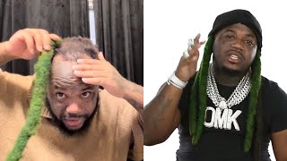 Reggie Baybee Explains Why He Going BALD [upl. by Asital]