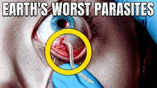 The CREEPIEST Parasites on Earth [upl. by Areic907]