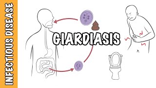 Giardiasis  Giardia Lamblia Giardia intestinalis Giardia duodenalis infection [upl. by Rufe]