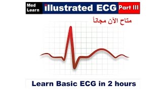 ECG Quick Review Part 3 internalmedicine cme medicaleducation ecg  محاضراتباطنة [upl. by Leeth]