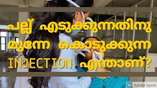 Local Anasthesia for tooth extraction  Explained in Malayalam  Dr Anagha Cheleri [upl. by Dahs]