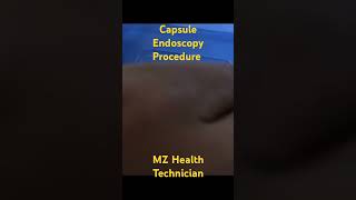 Capsule Endoscopy Procedure [upl. by Nifled]