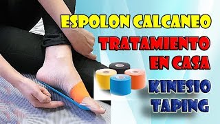 Tratamiento de espolón y fascitis plantar en casa con kinesio cinta [upl. by Gass441]