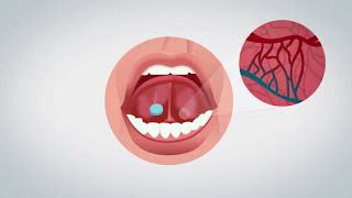 How to use WaferiX sublingual wafer [upl. by Mcwilliams]