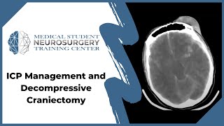 ICP Management and Decompressive Craniectomy [upl. by Sukhum946]