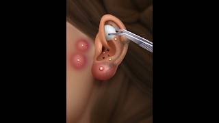 Asmr ear cleaning [upl. by Irby11]