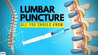 Lumbar Puncture Everything You Need to Know [upl. by Essilevi]