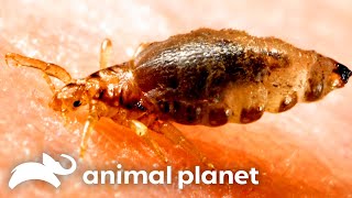 Botfly Larvae Living In Young Womans Scalp  Monsters Inside Me  Animal Planet [upl. by Ruddie]