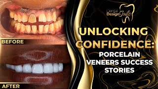 Unlocking confidente Porcelain Veneers sucess stories [upl. by Shellans437]