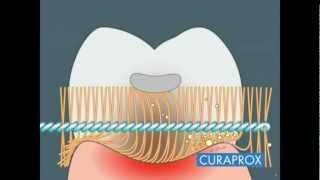 Interdental Care  How To [upl. by Yenalem]