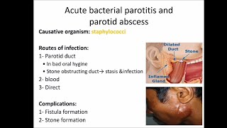 salivary gland infections [upl. by Meagher]