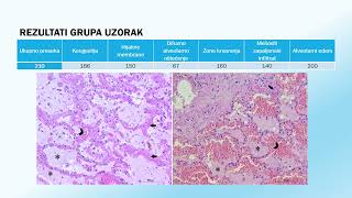 Doktorat  Jelena Kuzmanović  Uloga interleukina 6 8 i 18 u patogenezi akutnog respiratornog [upl. by Gerda814]